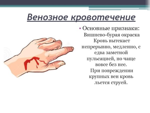 Признаки венозного кровотечения