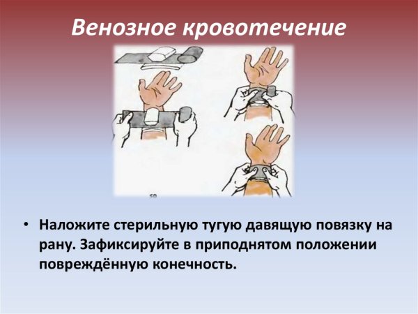 Осложнения при венозном кровотечении