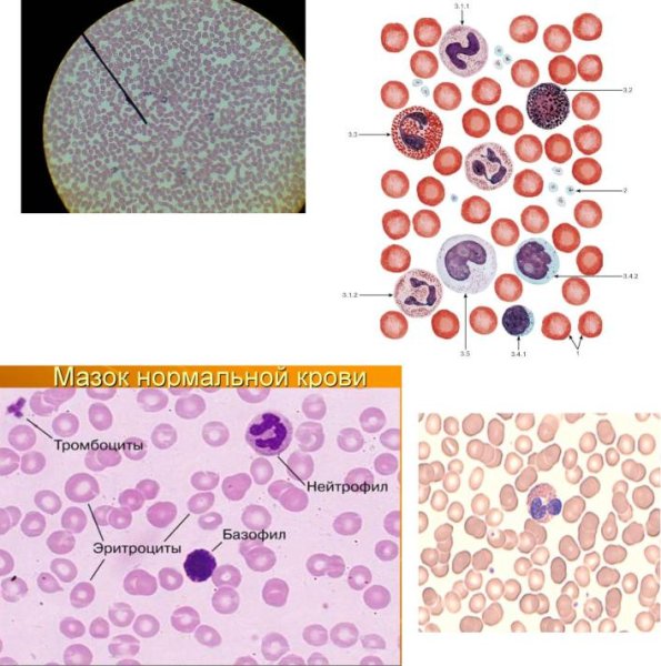 Препарат мазок крови человека окраска Азур 2-эозином