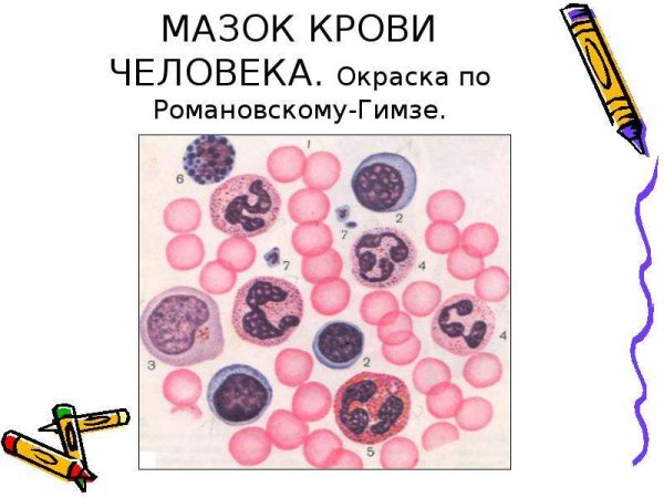 Мазок крови окрашенный по Романовскому-Гимзе