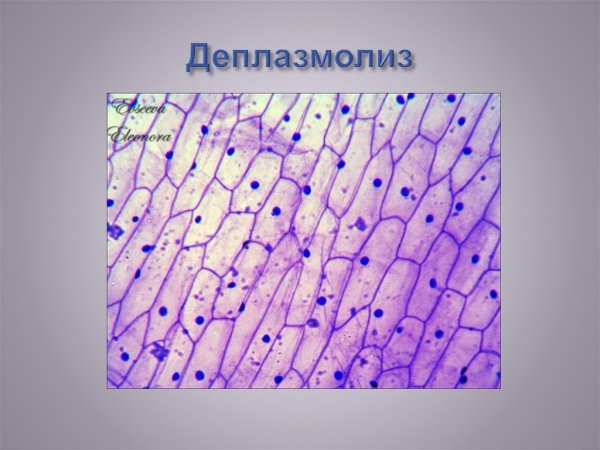 Плазмолиз в клетках кожицы лука