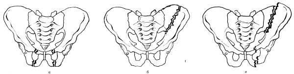 Таз анатомия тазовое кольцо
