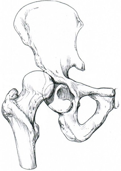 Баммес тазовая кость