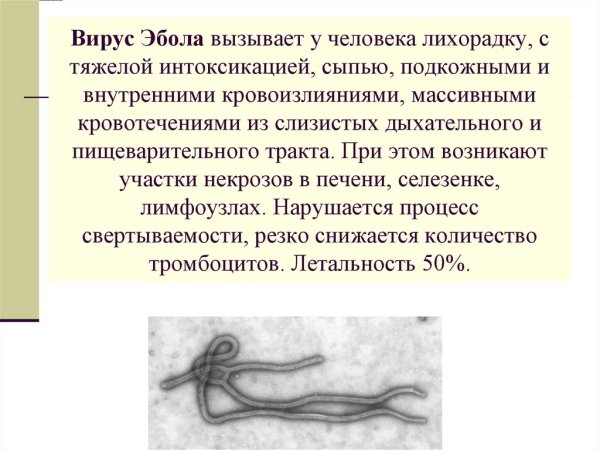 Лихорадка Эбола строение вируса