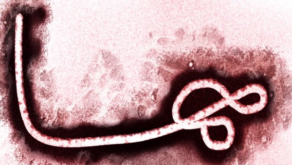 Вирус Эбола (геморрагическая лихорадка)