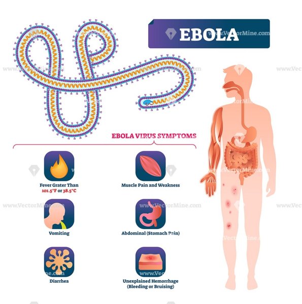 Геморрагическая лихорадка Эбола (филовирусы Ebola virus);