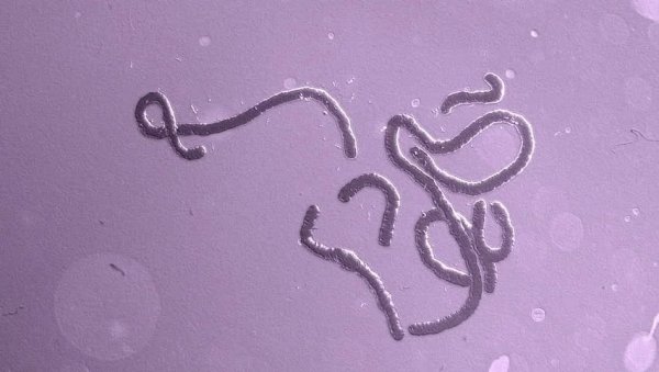 Лихорадка Эбола симптомы