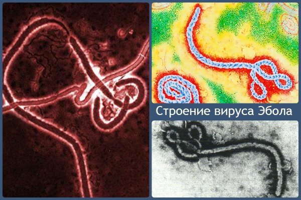 Лихорадка Эбола возбудитель