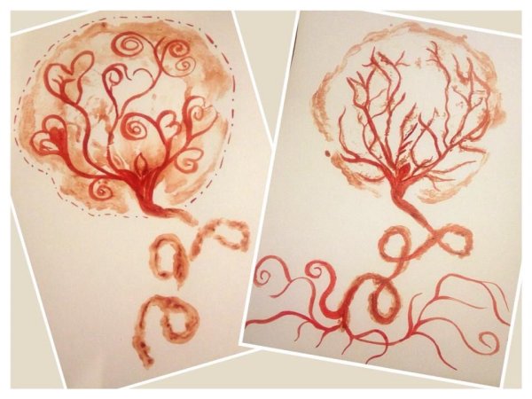 Котиледон плаценты