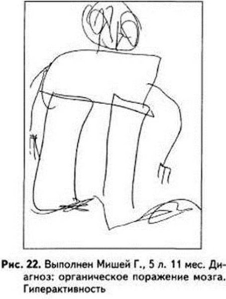 Рисунок человека ребенка с умственной отсталостью