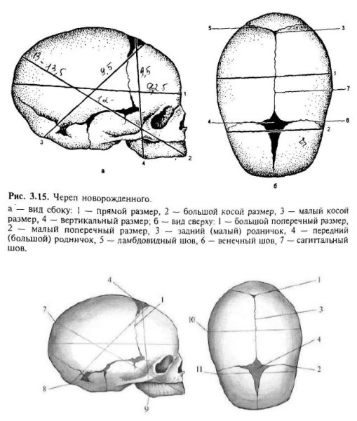 Череп новорожденного швы и роднички