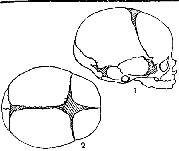 Роднички черепа анатомия