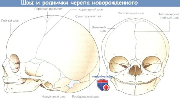 Швы и роднички головки новорожденного