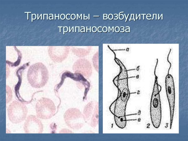 Трипаносома cruzi