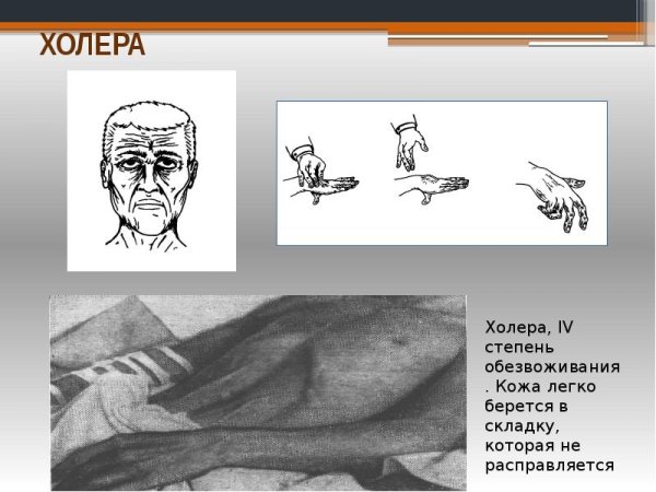 Больные холерой рисунки