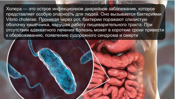 Холера Роспотребнадзор