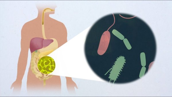 Холера Советский плакат