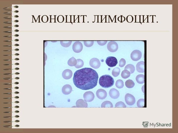 Лимфоцит рисунок