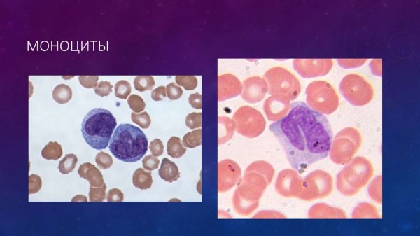 Морфология клеток крови моноцит
