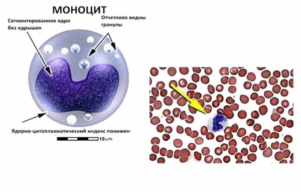Характерное строение моноцитов