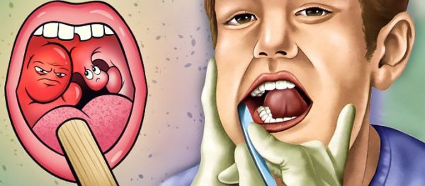 Больное горло рисунок