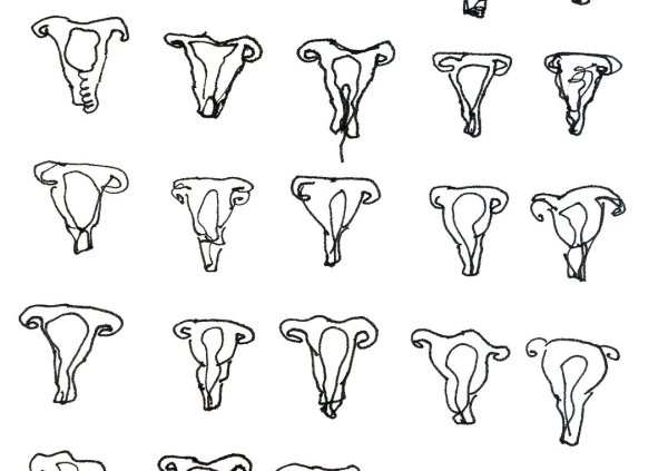 Репродуктивная система мужчины схема