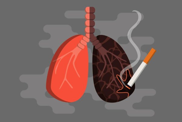 Здоровые и нездоровые легкие