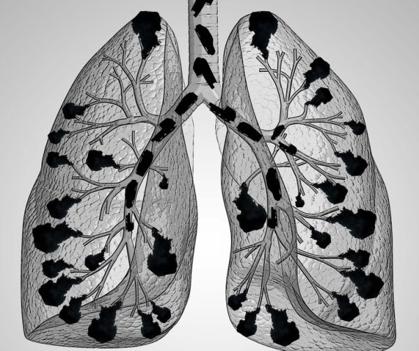 Легкие курильщика рисунок