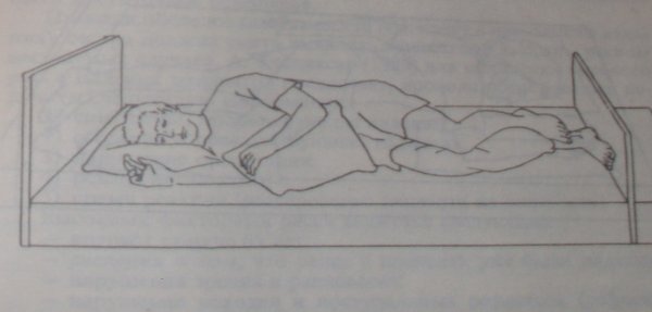 Укладывание пациента на бок