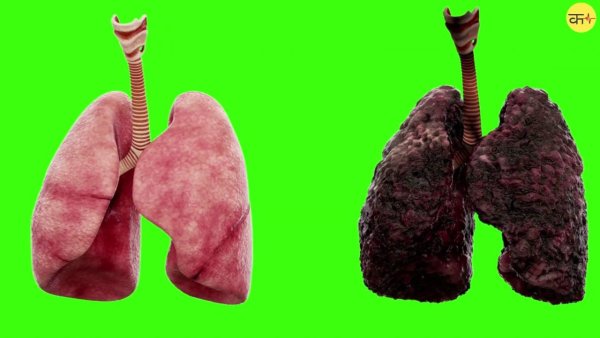 Лёгкие здорового человека и курильщика
