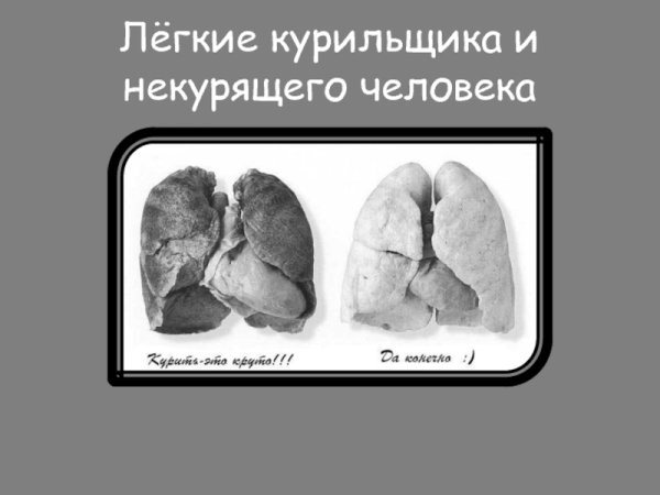 Легкие человека курильщика