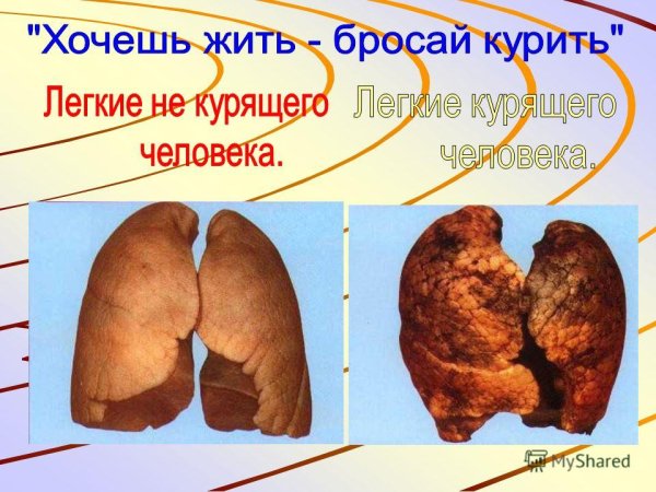 Презентация о вреде курения