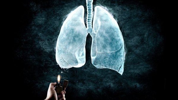 Здоровые легкие и легкие курильщика