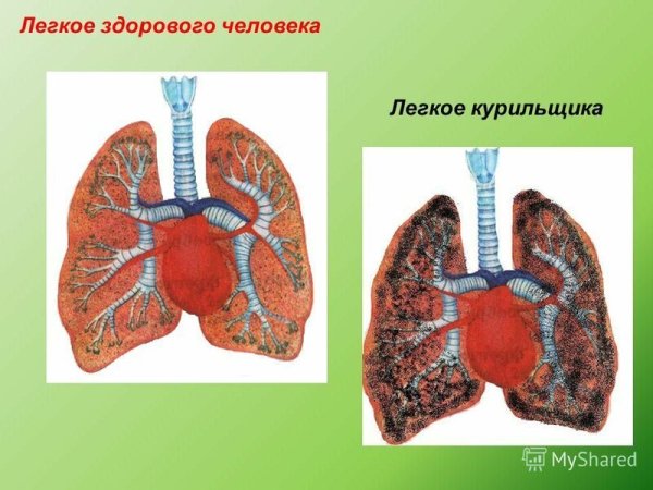 Легкие курящего человека