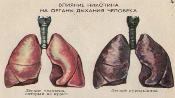 Лёгкие курильщика рисунок