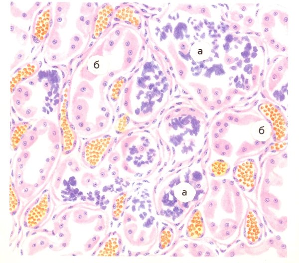 Бурая индурация легких патанатомия