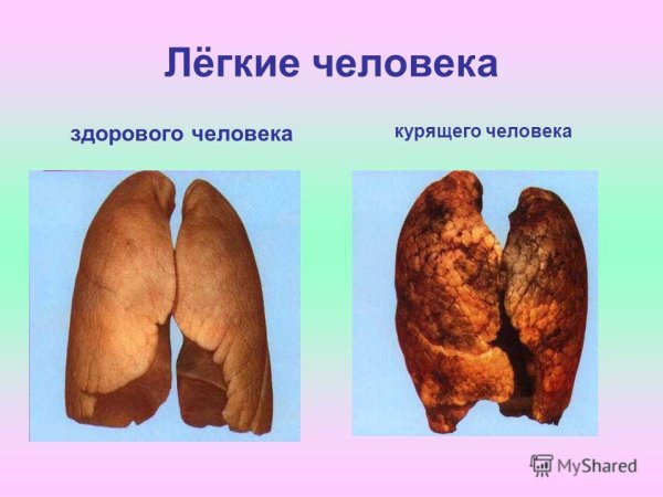 Курение лёгкие иллюстрации