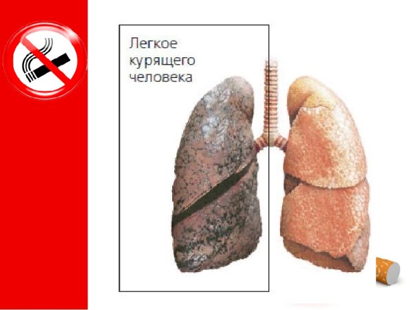 Легкие курильщика и здорового