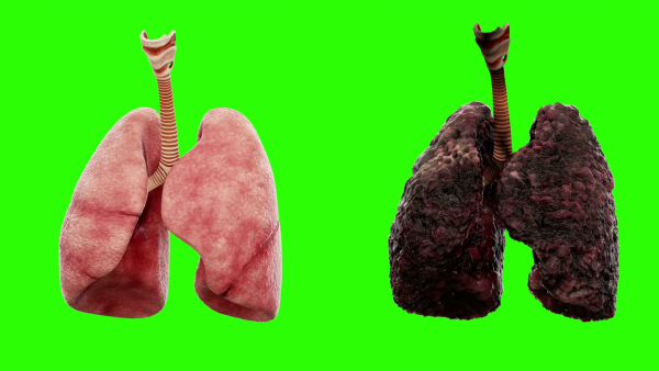 Лёгкие человека карандалом