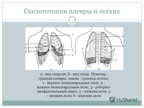 Плевральные синусы на рентгене