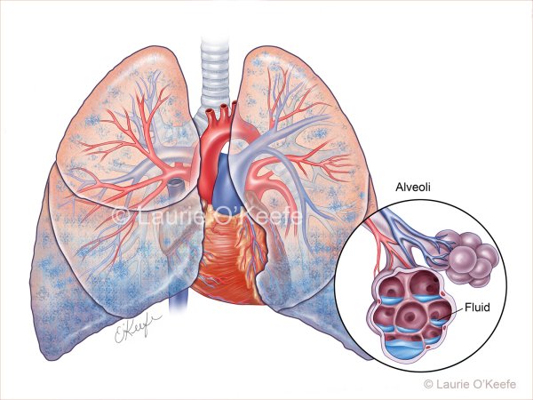 Отек легких Ветеринария