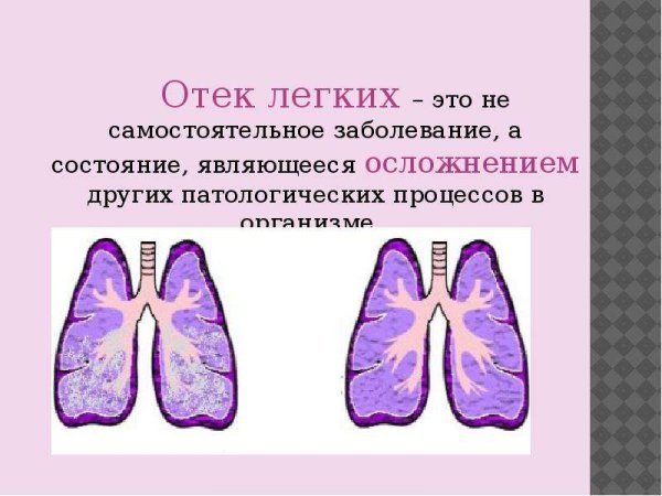 Гиперемия и отек легких у животных