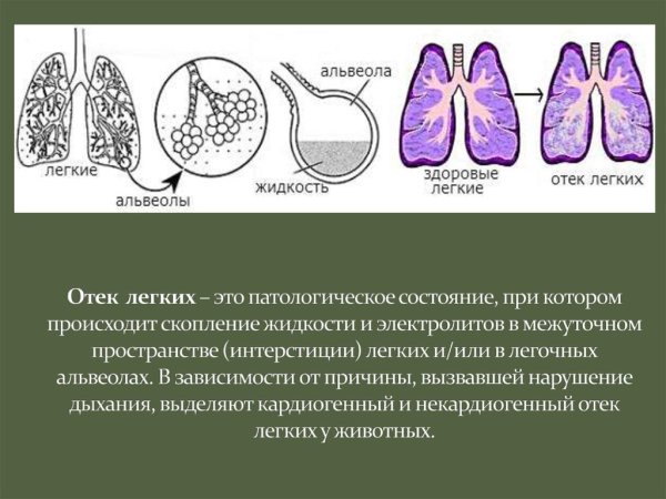 Отёк лёгких при коронавирусе