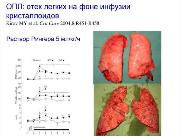 Кардиагенный отёк лёгких