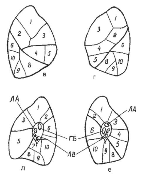 S6 сегмент левого легкого