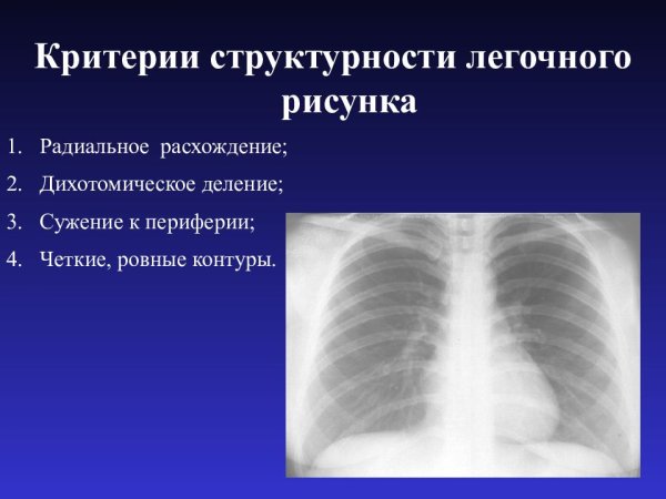 Ослабление легочного рисунка