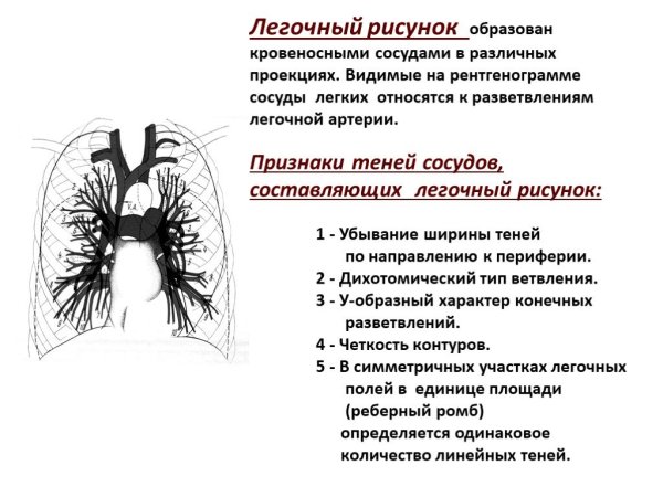Рентген корней легких