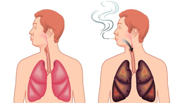 Курение мультяшные