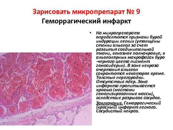 Атлас патологической анатомии Зайратьянц