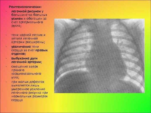 Острый бронхит снимок рентген